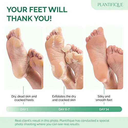 Miniatyr: Plantifique foot peel sockor och användning