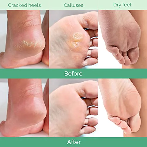 Miniatyr: Detaljbild av Plantifique Peach Foot Exfoliation Mask